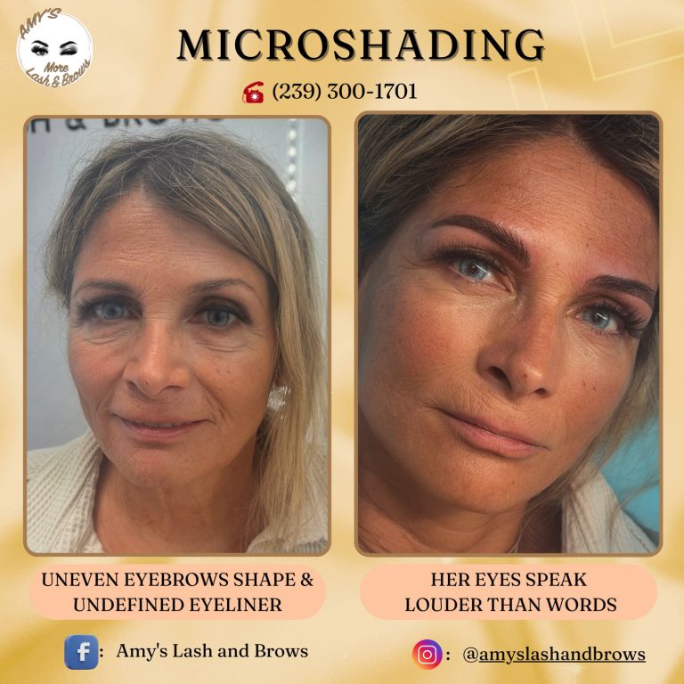 microshading1