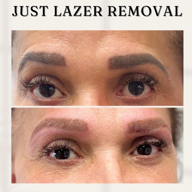 Fix eyebrows2